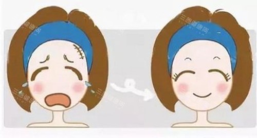 激光美容前后對(duì)比卡通示意圖